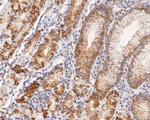 FAT1 Antibody in Immunohistochemistry (Paraffin) (IHC (P))