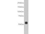 TMEM132A Antibody in Western Blot (WB)