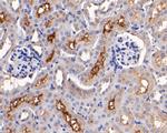 TMEM67 Antibody in Immunohistochemistry (Paraffin) (IHC (P))
