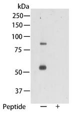 TMEM2 Polyclonal Antibody