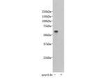 TMEM132E Polyclonal Antibody