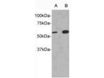 IL13RA1 Polyclonal Antibody
