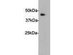 SERPINA5 Polyclonal Antibody