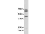 CSF2RA Polyclonal Antibody