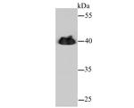 alpha-Cardiac Actin Polyclonal Antibody