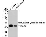 alpha-Cardiac Actin Antibody in Western Blot (WB)