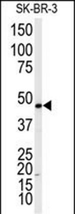 beta-2 Adrenergic Receptor Polyclonal Antibody