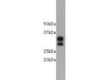 CD8 Antibody in Western Blot (WB)