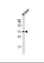 HMX2 Antibody in Western Blot (WB)
