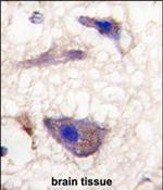 NPTX1 Polyclonal Antibody