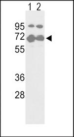 Nrf2 Polyclonal Antibody