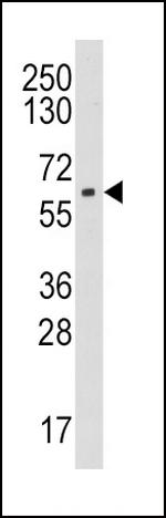 Aromatase Antibody in Western Blot (WB)