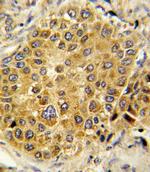 Plasminogen Polyclonal Antibody