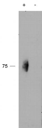 Phospho-CD244 (Tyr271) Antibody in Immunoprecipitation (IP)