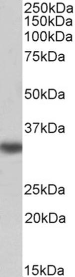 TMX Polyclonal Antibody, Biotin