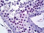 TSPYL2 Antibody in Immunohistochemistry (Paraffin) (IHC (P))