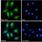 ATF6 Antibody in Immunocytochemistry (ICC/IF)
