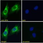ATF6 Polyclonal Antibody