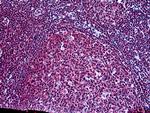 SH3KBP1 Antibody in Immunohistochemistry (Paraffin) (IHC (P))