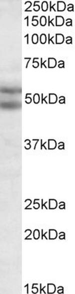 BAG5 Antibody in Western Blot (WB)