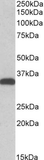 CBR3 Polyclonal Antibody