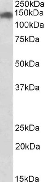 SMC2 Polyclonal Antibody