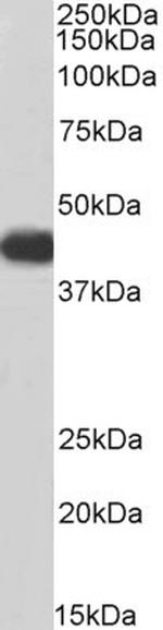 ACADM Polyclonal Antibody, Biotin