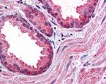 CCNDBP1 Antibody in Immunohistochemistry (Paraffin) (IHC (P))