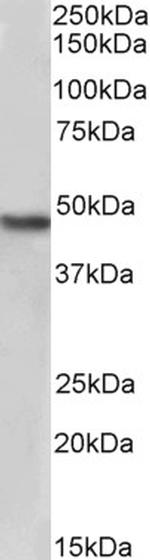 NDRG1 Polyclonal Antibody, Biotin