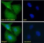UBE2S Polyclonal Antibody