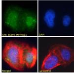 ZMYND11 Polyclonal Antibody