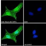 DPF1 Polyclonal Antibody