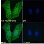 TRAK2 Polyclonal Antibody