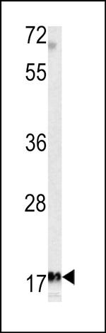 MFAP5 Antibody in Western Blot (WB)