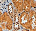 RNF92 Polyclonal Antibody