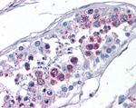 EVC2 Antibody in Immunohistochemistry (Paraffin) (IHC (P))
