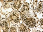 HYD Polyclonal Antibody