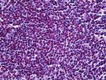 HYD Antibody in Immunohistochemistry (Paraffin) (IHC (P))