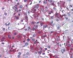 MERTK Antibody in Immunohistochemistry (Paraffin) (IHC (P))