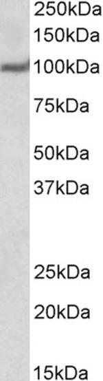 USP4 Polyclonal Antibody
