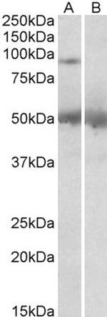 USP6 Polyclonal Antibody