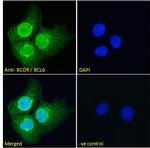 BCOR Polyclonal Antibody
