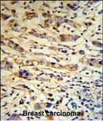 A1BG Polyclonal Antibody