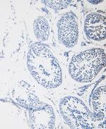 Cystatin B Antibody in Immunohistochemistry (Paraffin) (IHC (P))