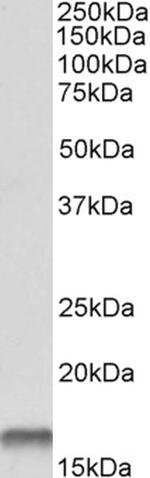 Cystatin B Antibody in Western Blot (WB)