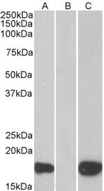 PHLDA3 Polyclonal Antibody