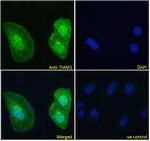 TIAM1 Polyclonal Antibody
