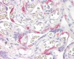 PHLDA2 Antibody in Immunohistochemistry (Paraffin) (IHC (P))