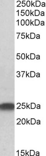 LIN7B Polyclonal Antibody