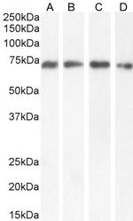 NUP62 Polyclonal Antibody
